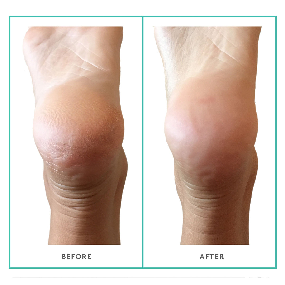 PoshPeel Pedi Cure