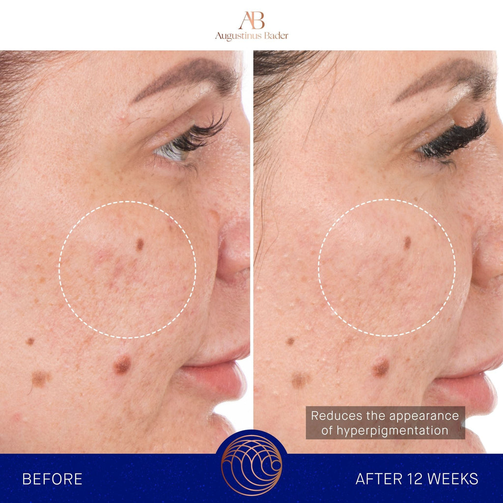 The Retinol Serum