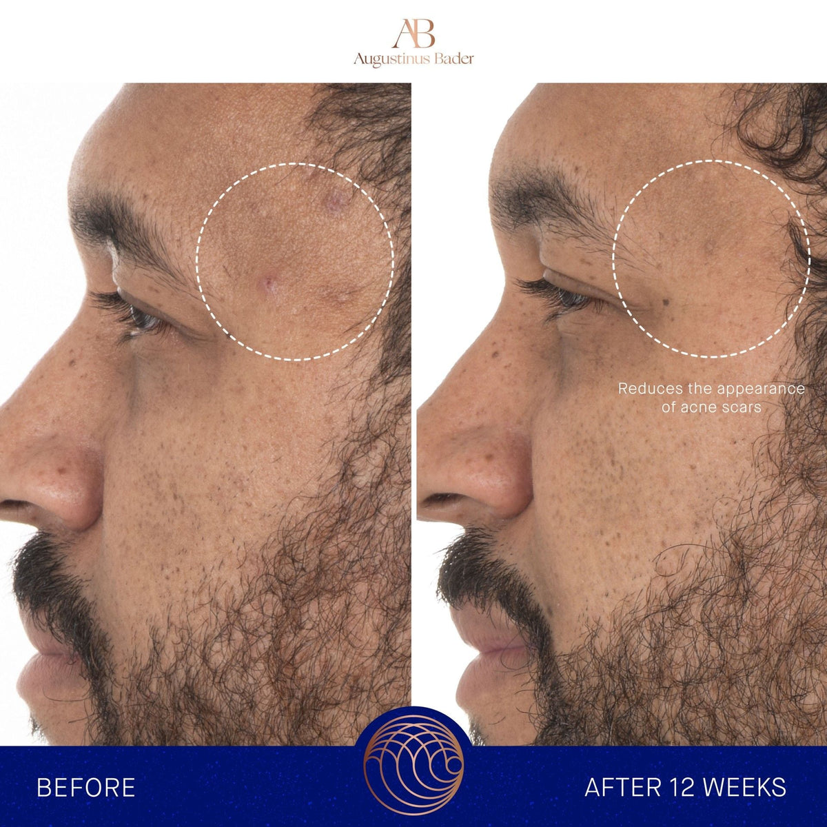 The Retinol Serum