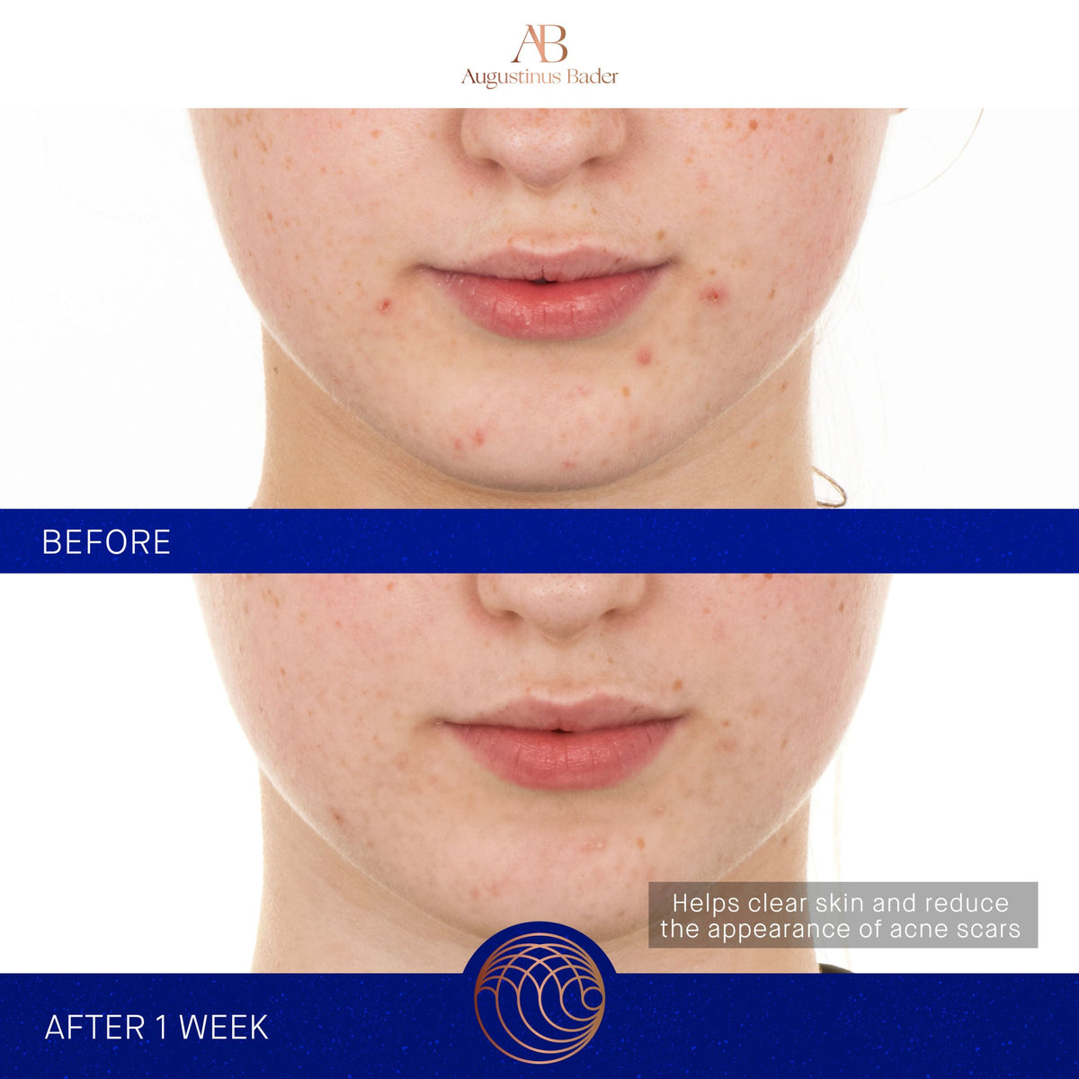 The Retinol Serum