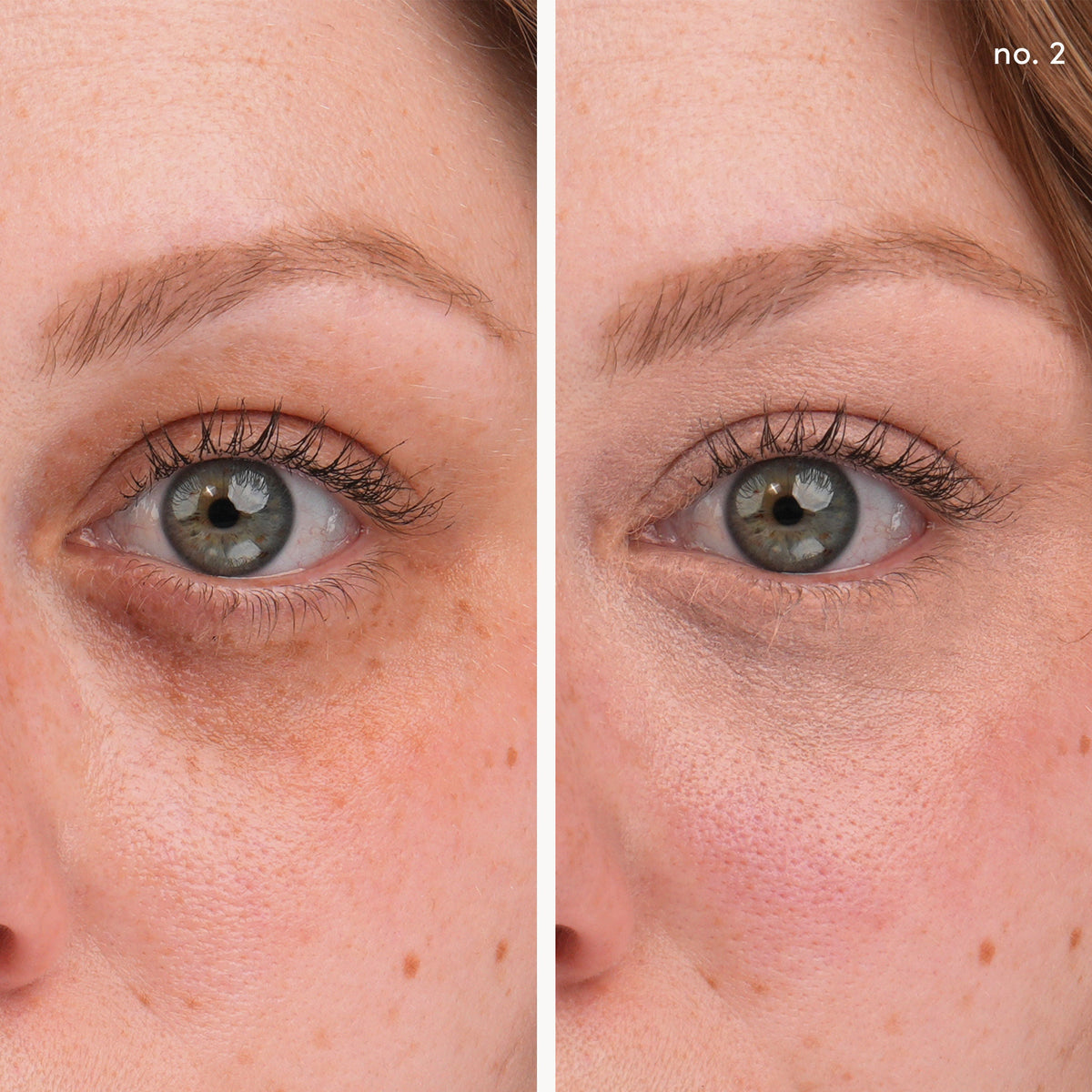 Circle/Delete Concealer