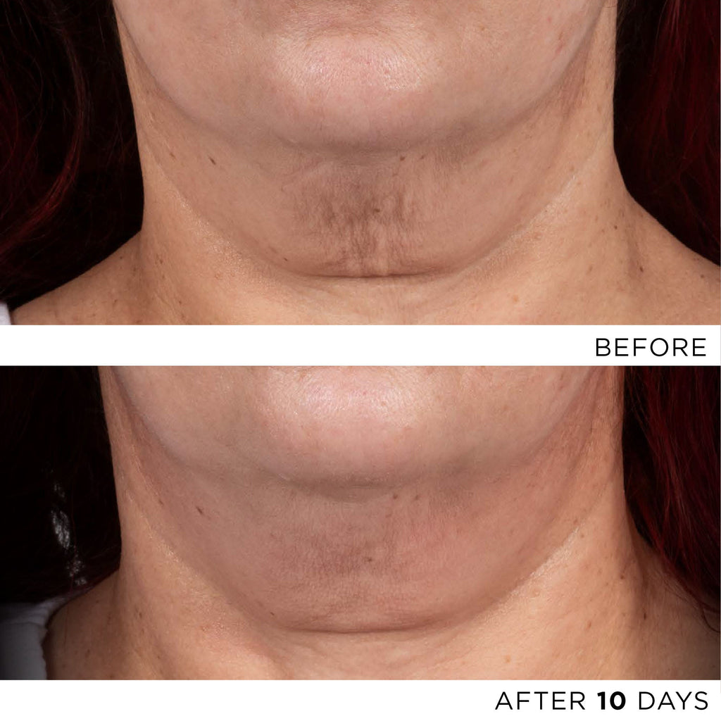 The Exceptional RetiNAD+ Renewal Booster