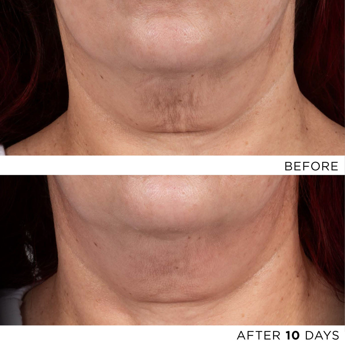 The Exceptional RetiNAD+ Renewal Booster