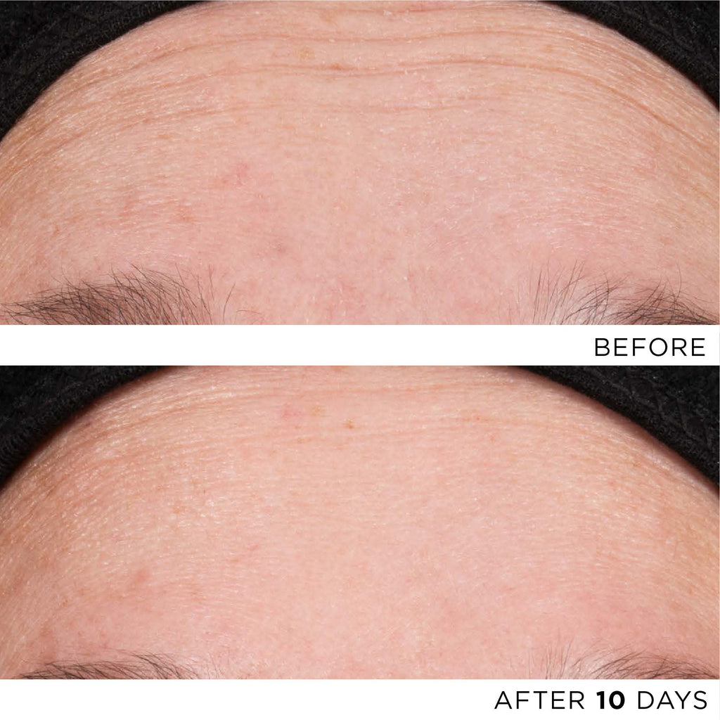 The Exceptional RetiNAD+ Renewal Booster