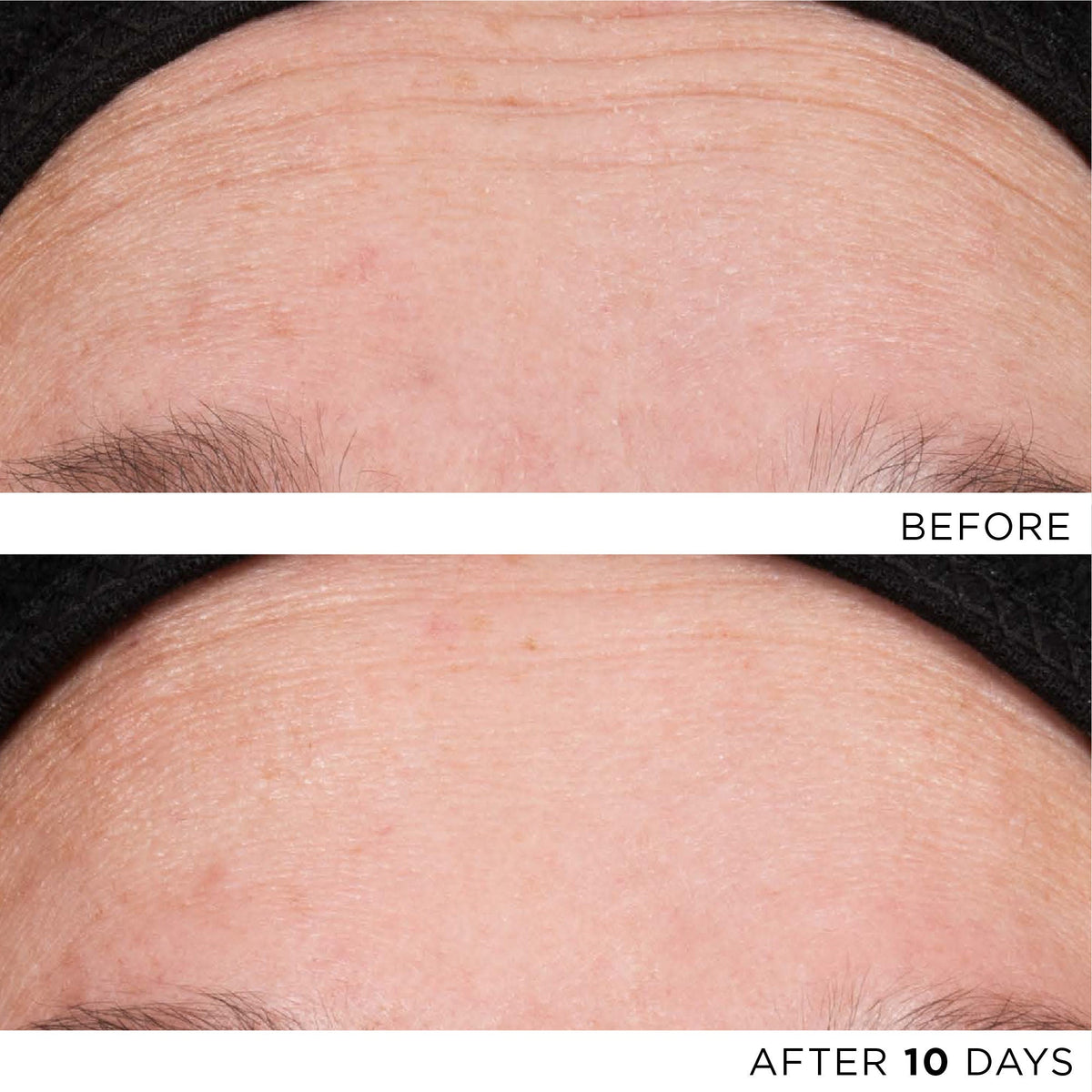 The Exceptional RetiNAD+ Renewal Booster
