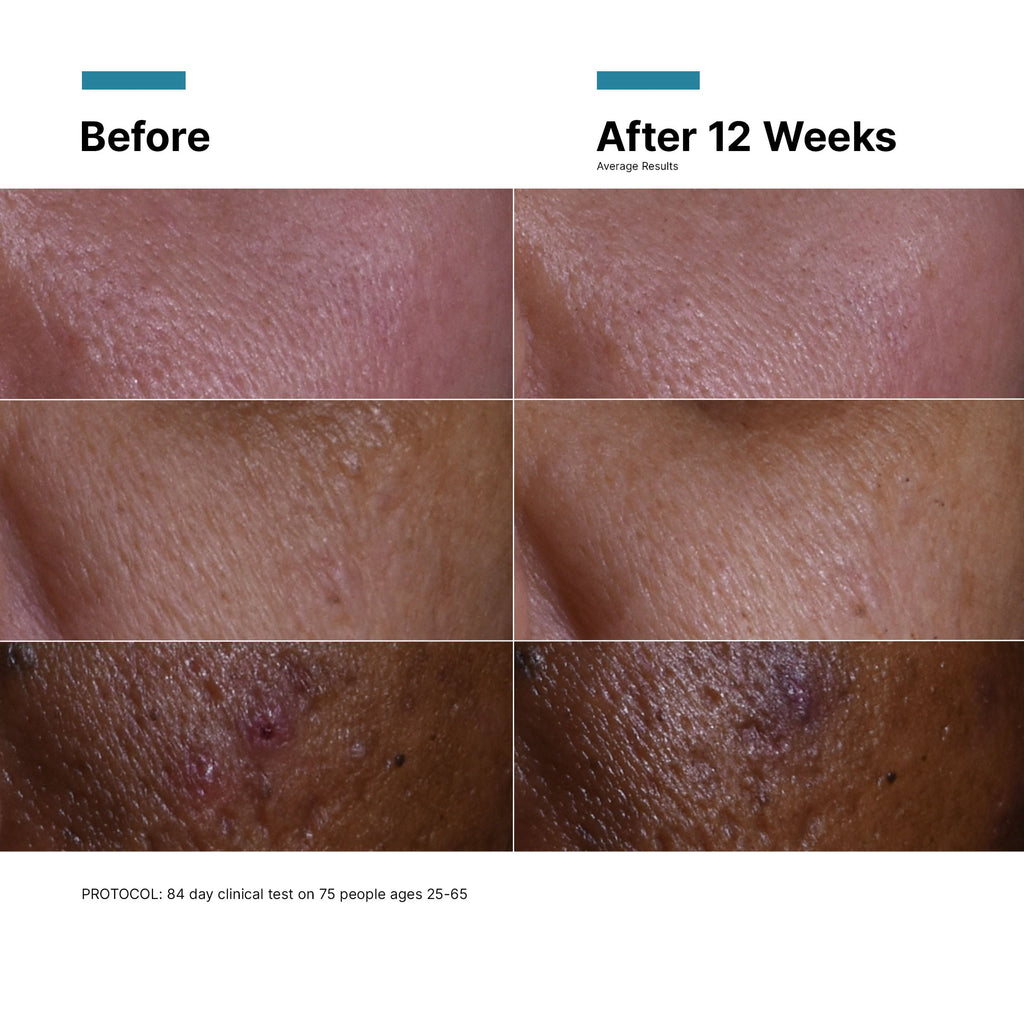 C E Ferulic