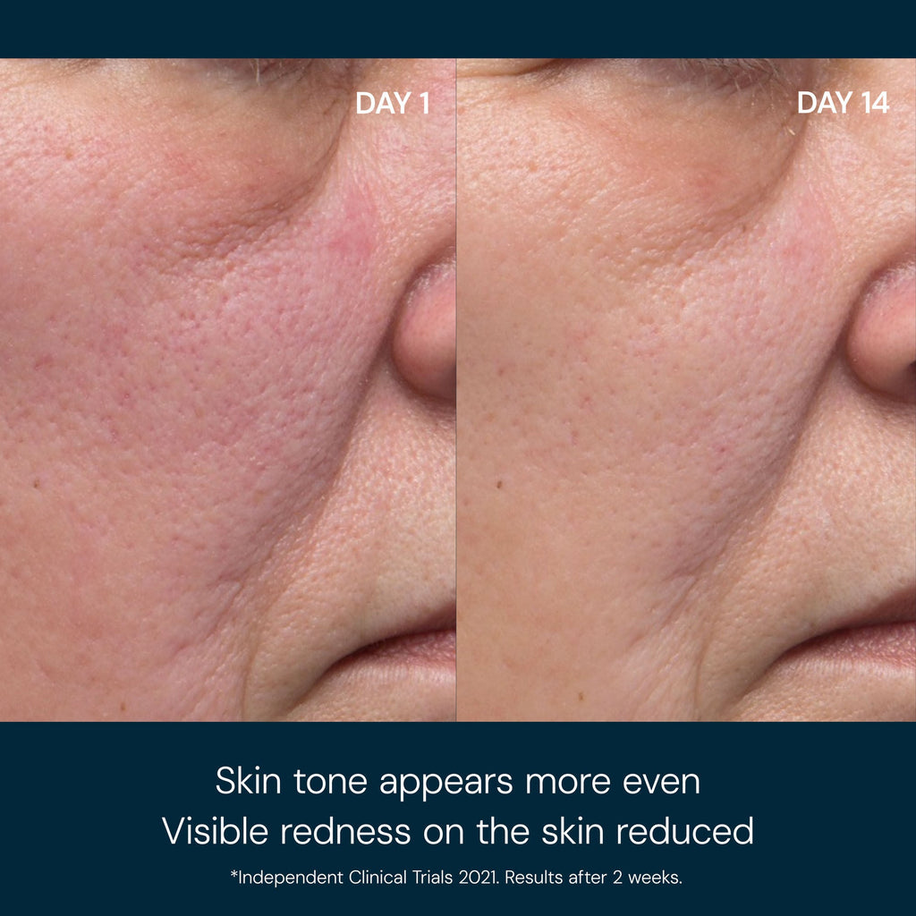 Dynamic Resurfacing Facial Pads