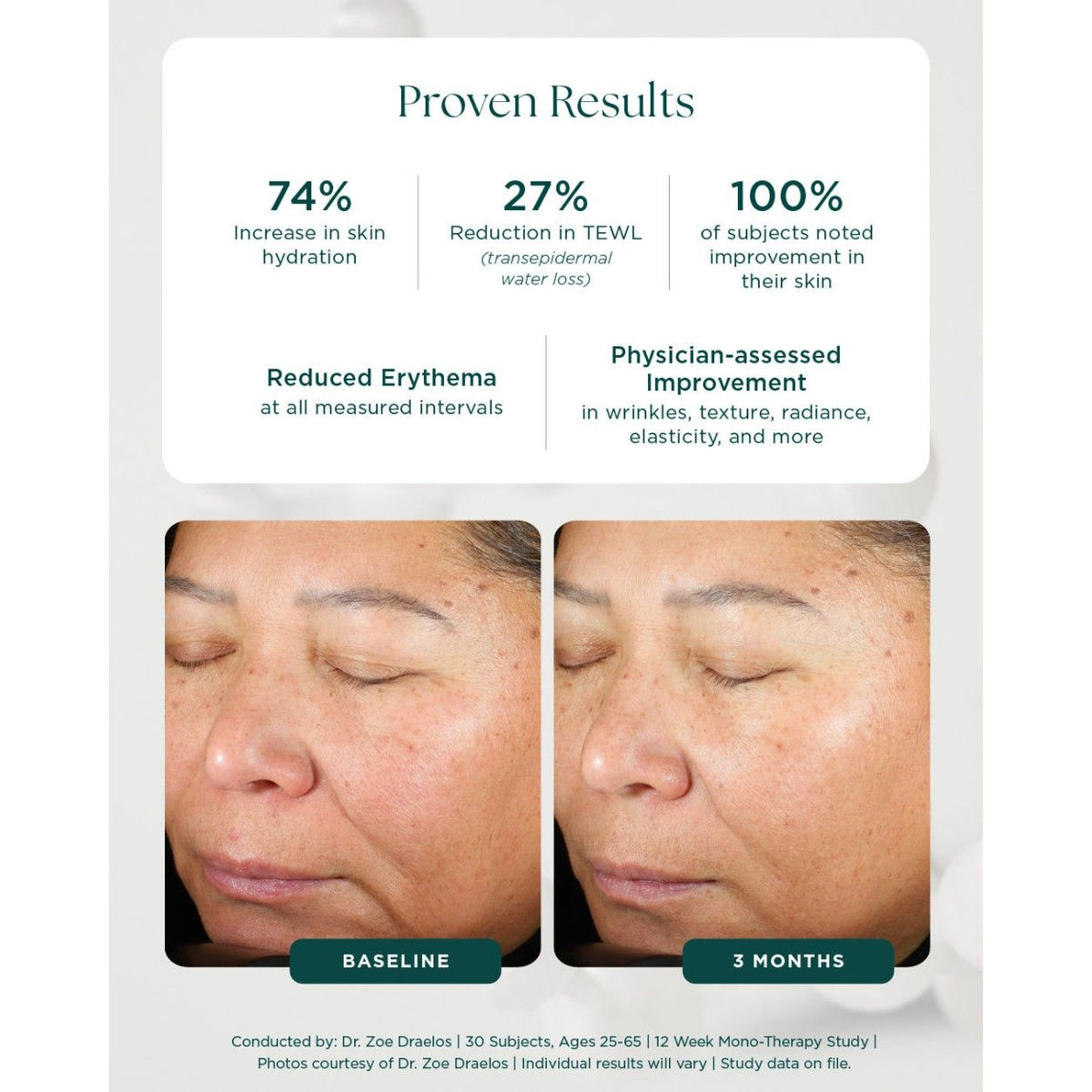 Marini Reboot™ PDRN Face Serum