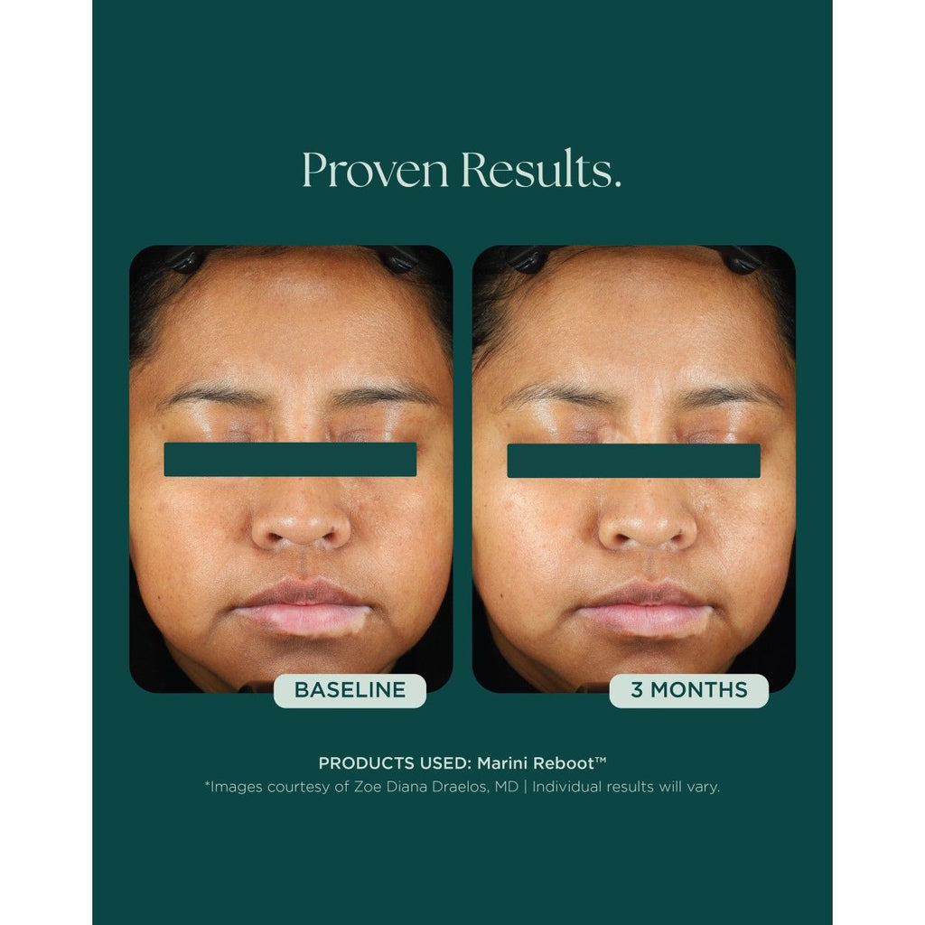 Marini Reboot™ PDRN Face Serum