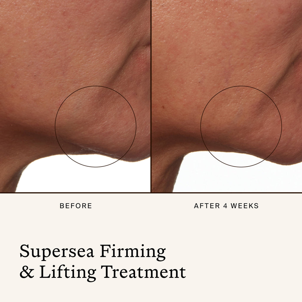 SuperSEA Firming & Lifting Treatment