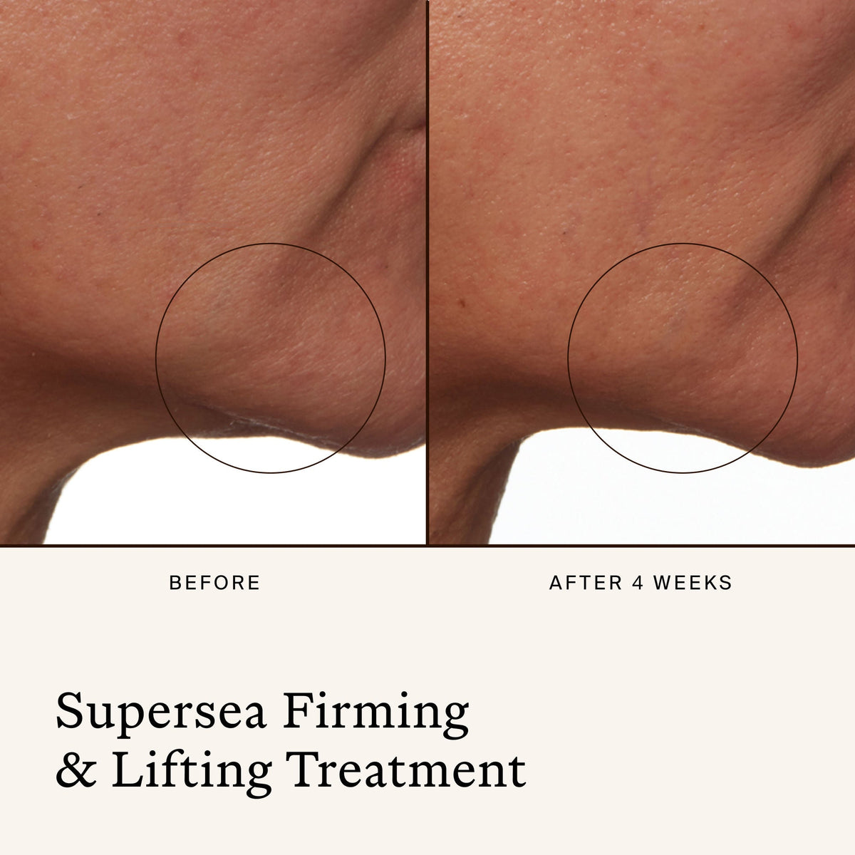SuperSEA Firming & Lifting Treatment