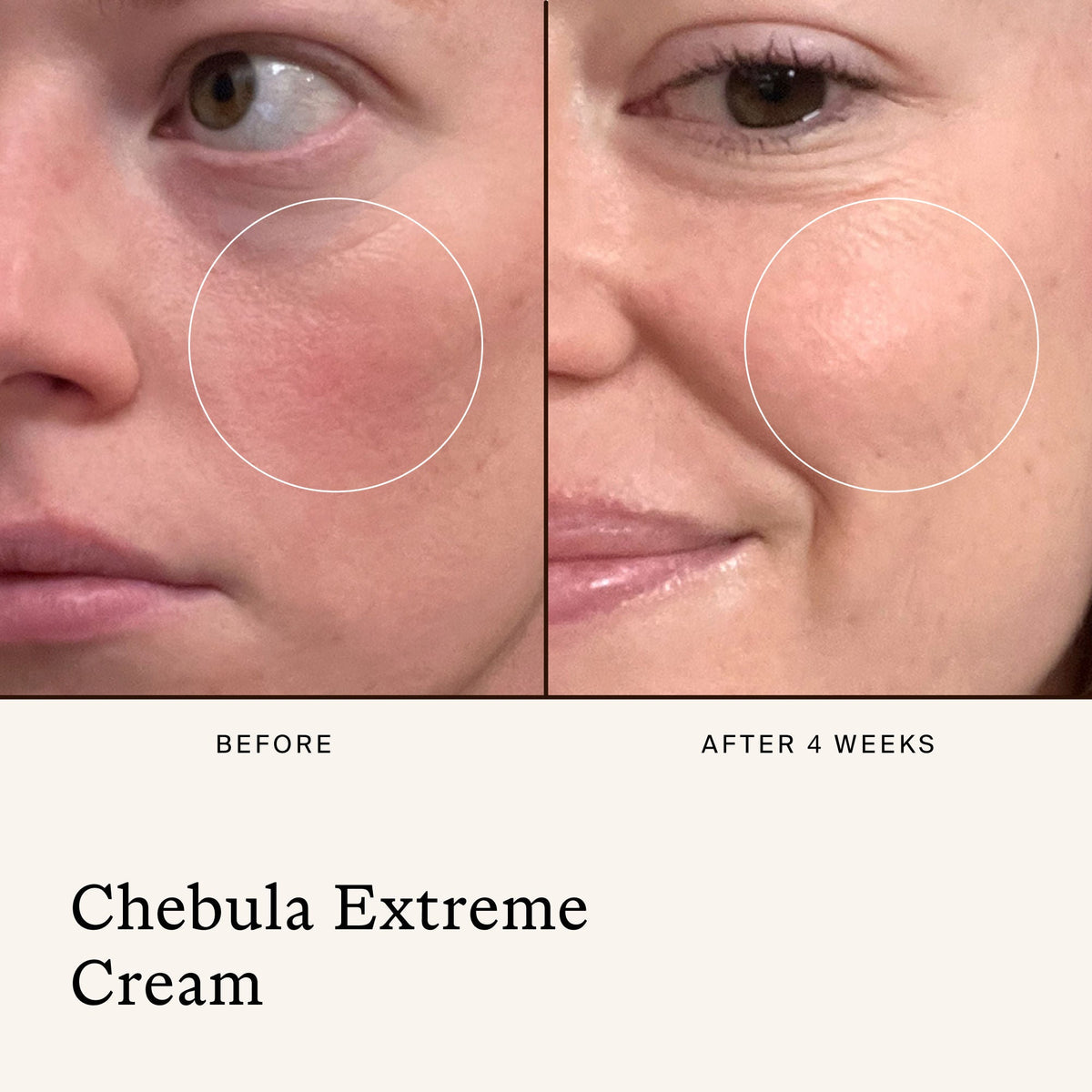 Chebula Extreme Cream