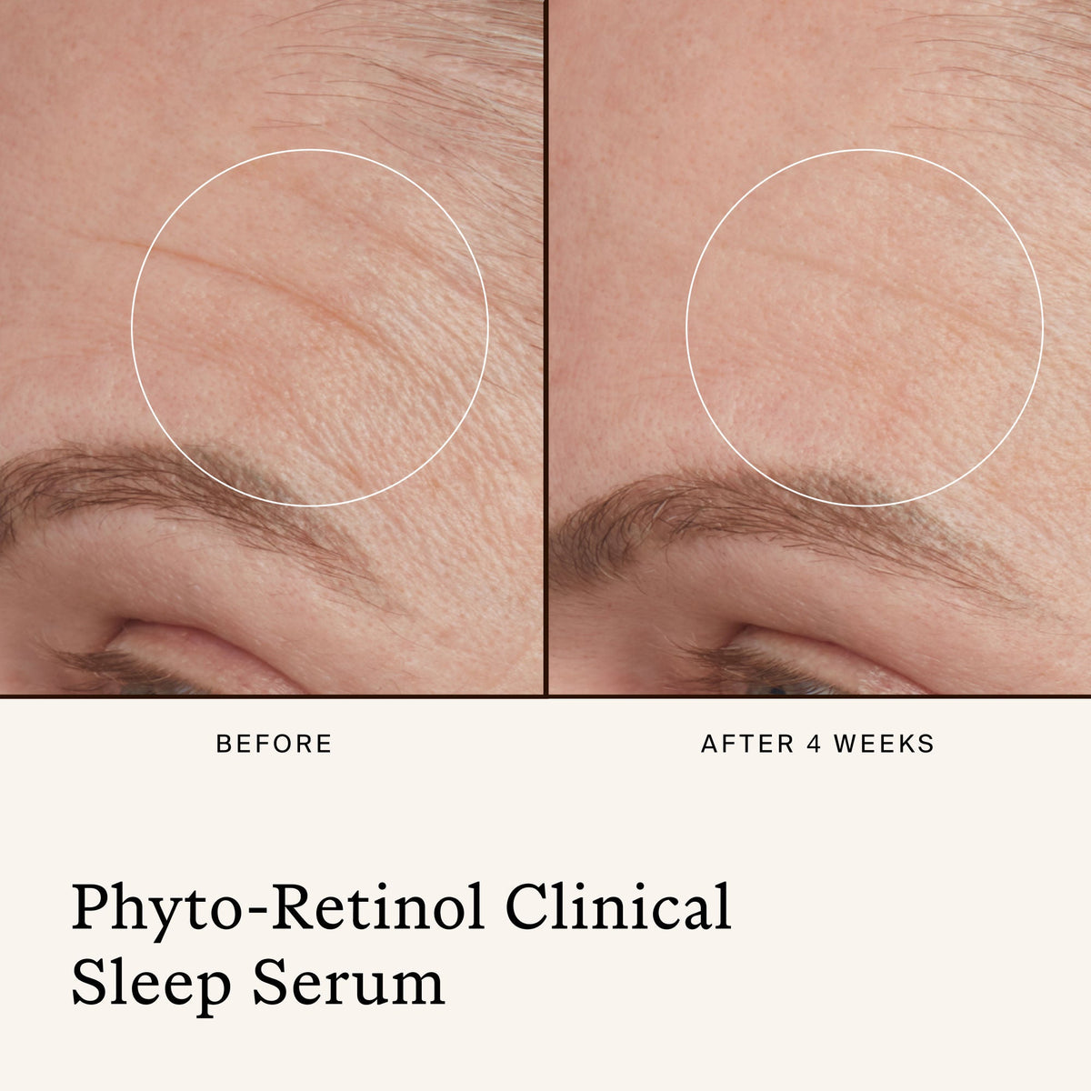 Phyto Retinol Clinical Serum