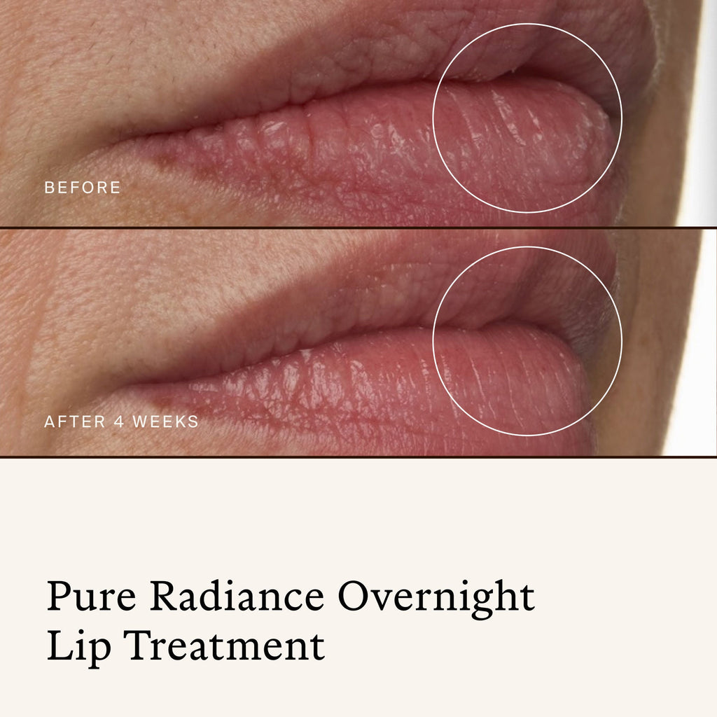 Pure Radiance Overnight Lip Treatment