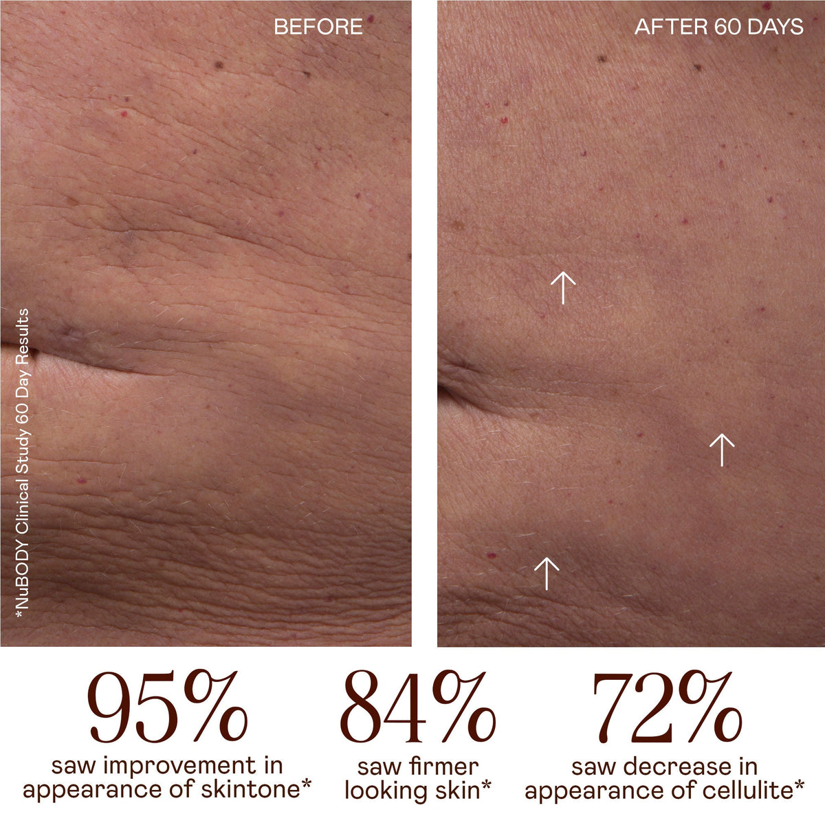 NuBODY Starter Kit Smooth & Tone Full Body Microcurrent Device