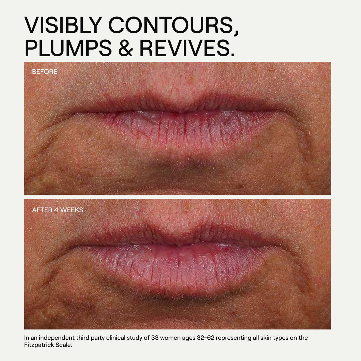 Contour Collection LipLift Hyaluron Peptide-6 Biofill