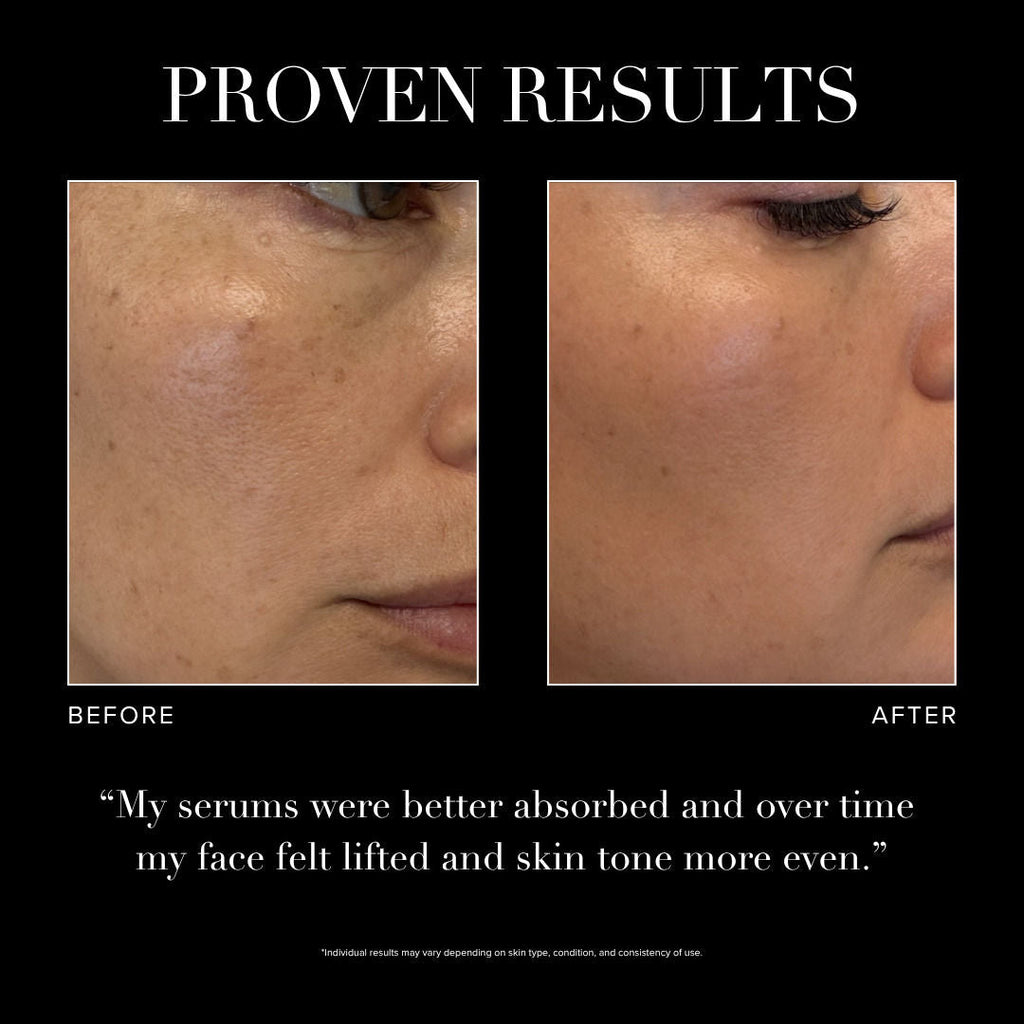 Serum Activation Wand