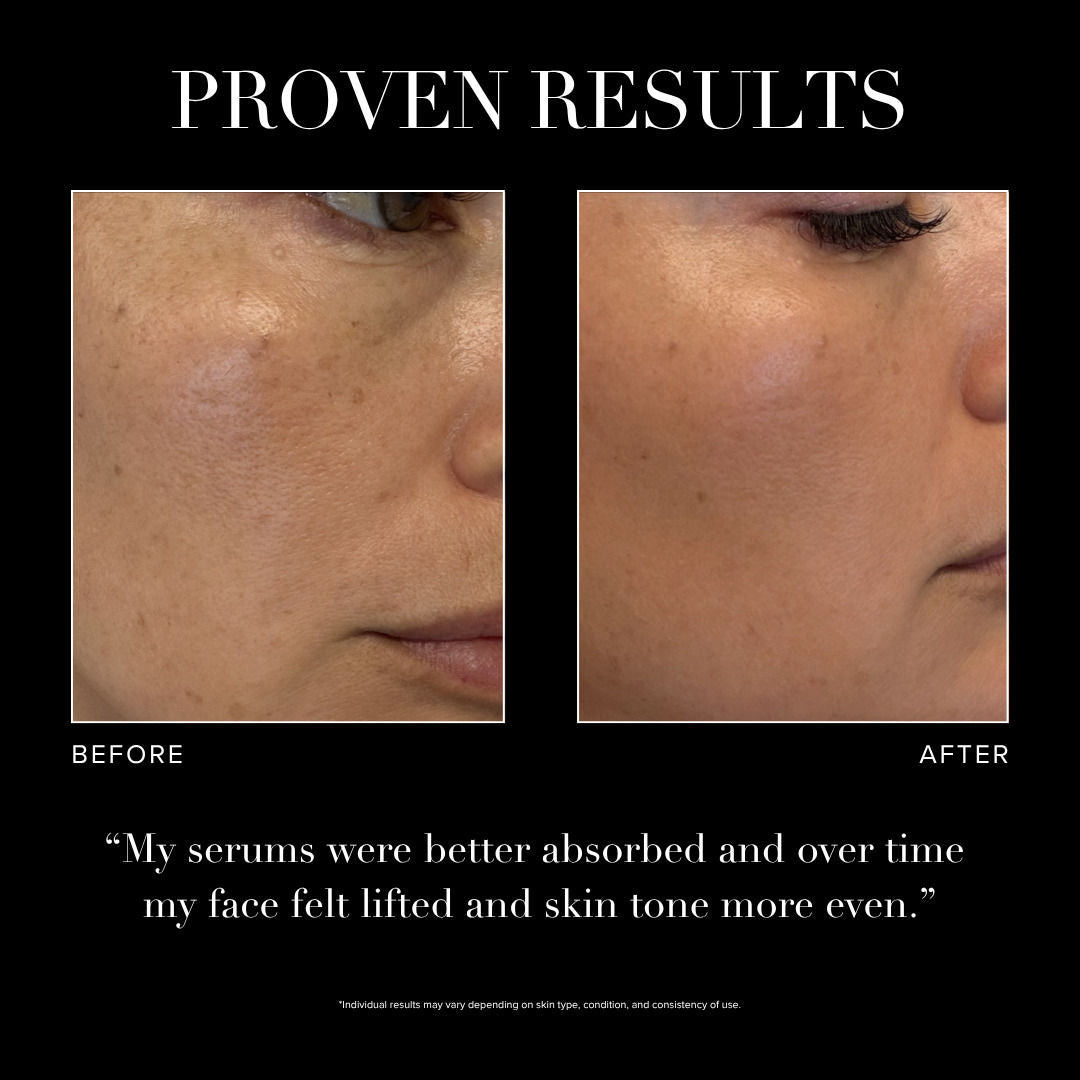 Serum Activation Wand