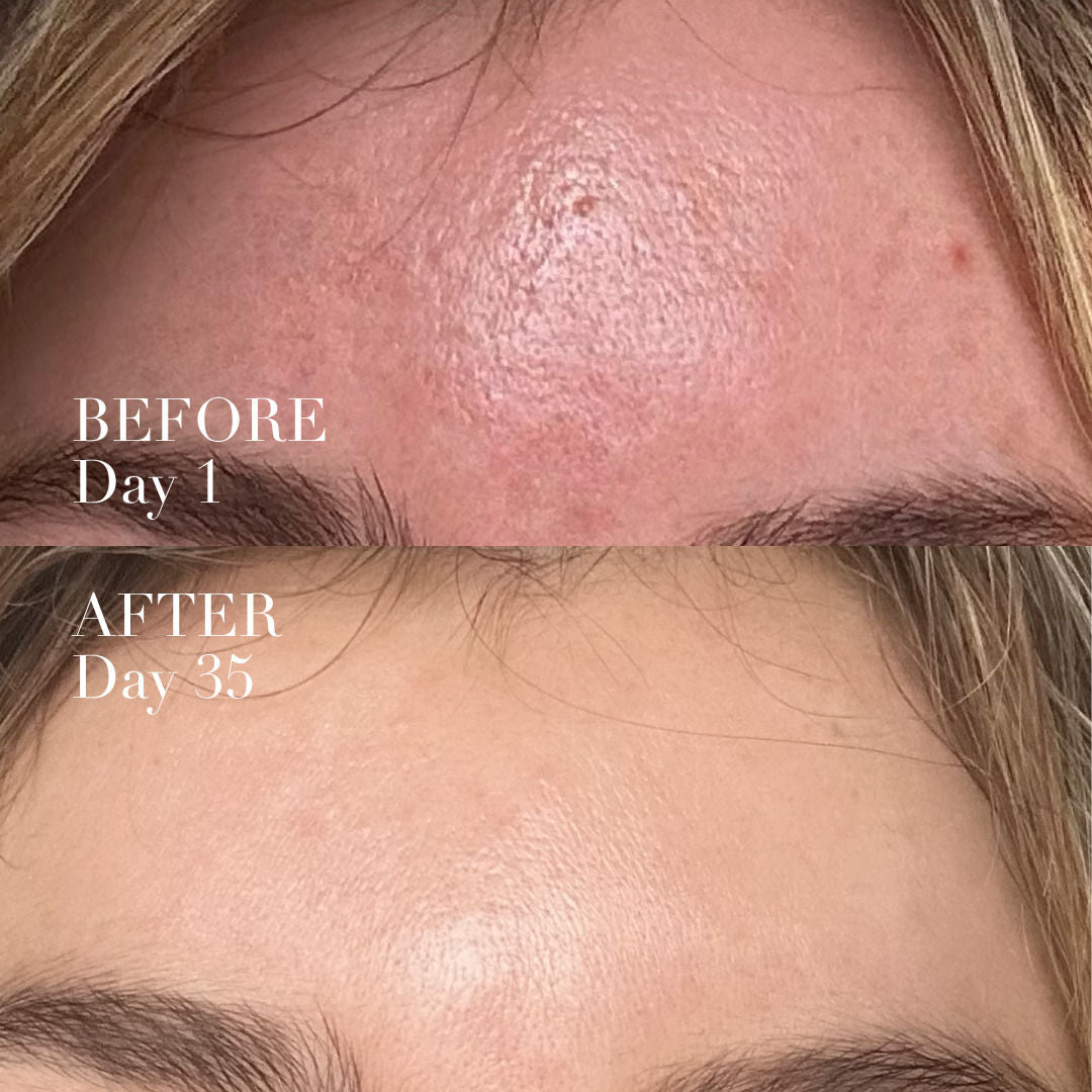 Serum Activation Wand