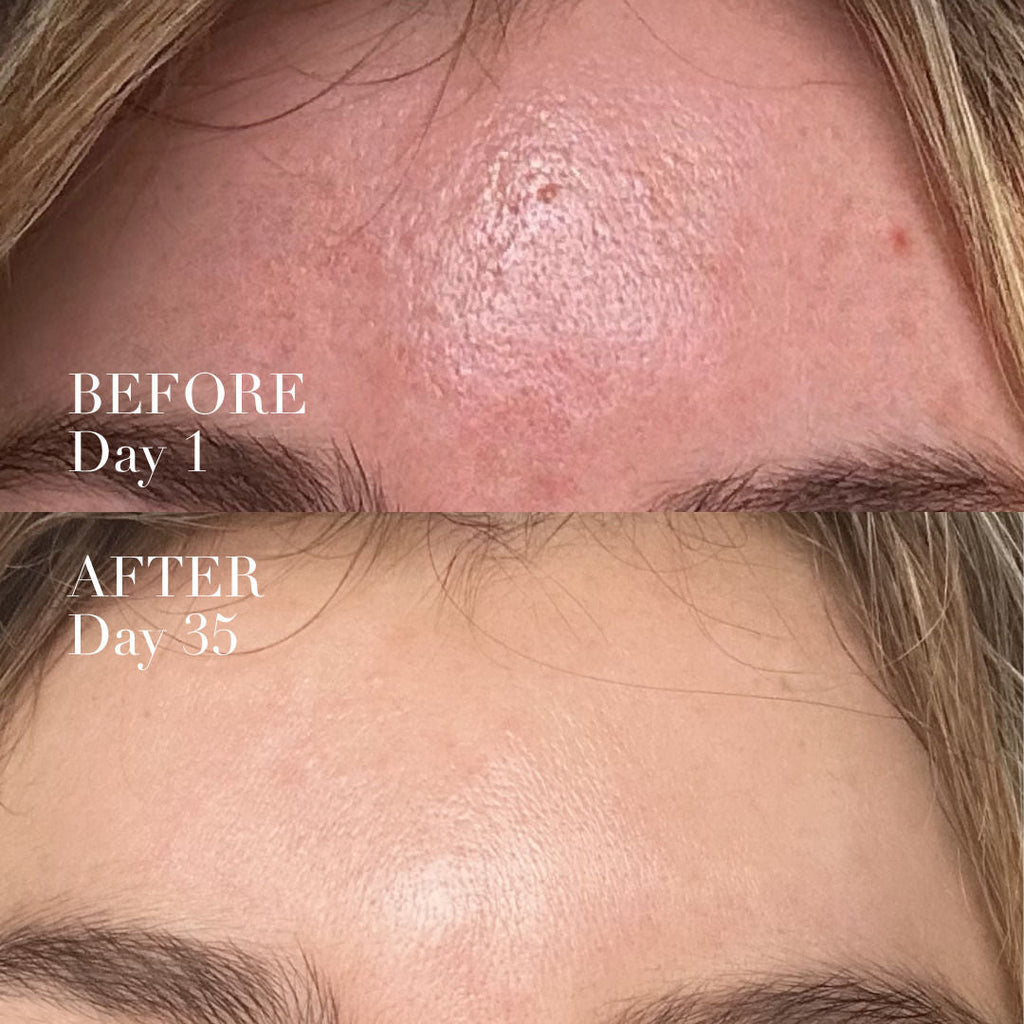Serum Activation Wand