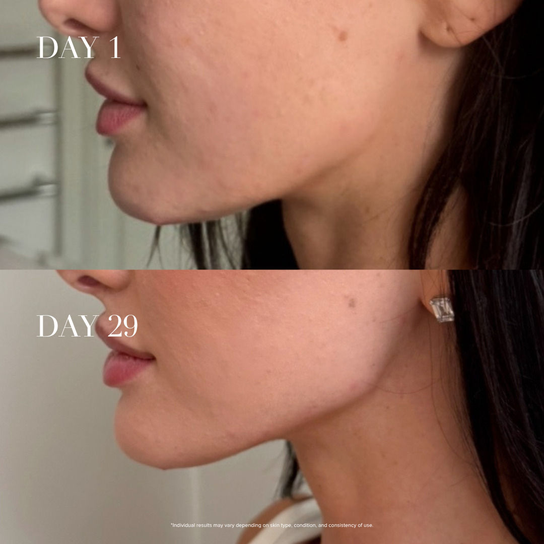 5-in-1 Face Pilates Wand