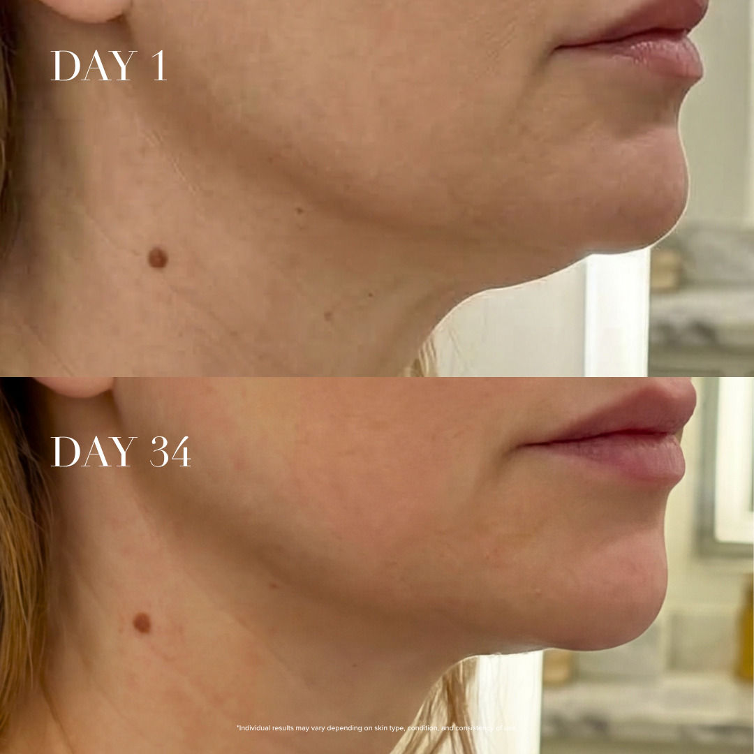 Cryo Glow Smoother