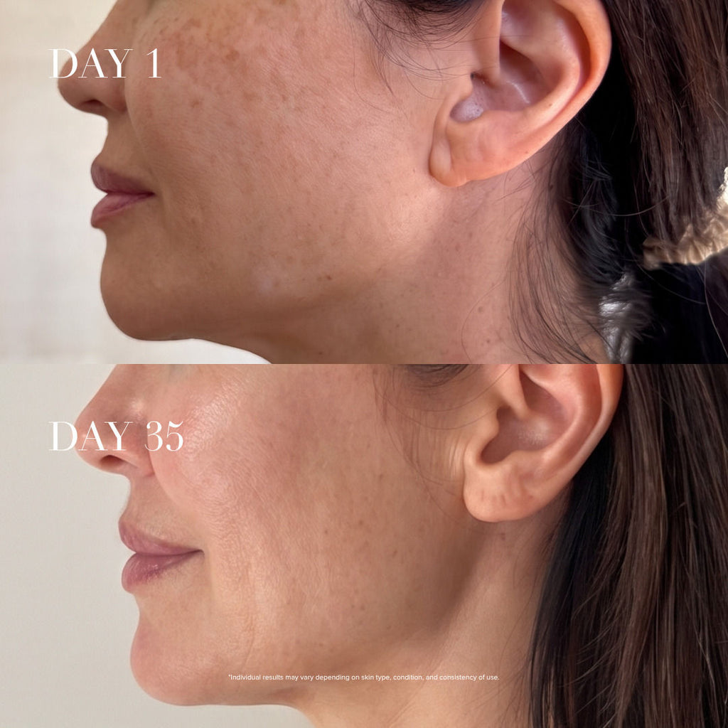 4D Pro Laser Light Therapy Face Mask