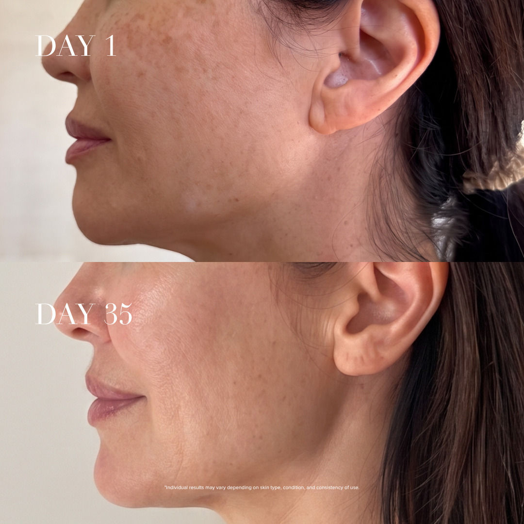 4D Pro Laser Light Therapy Face Mask