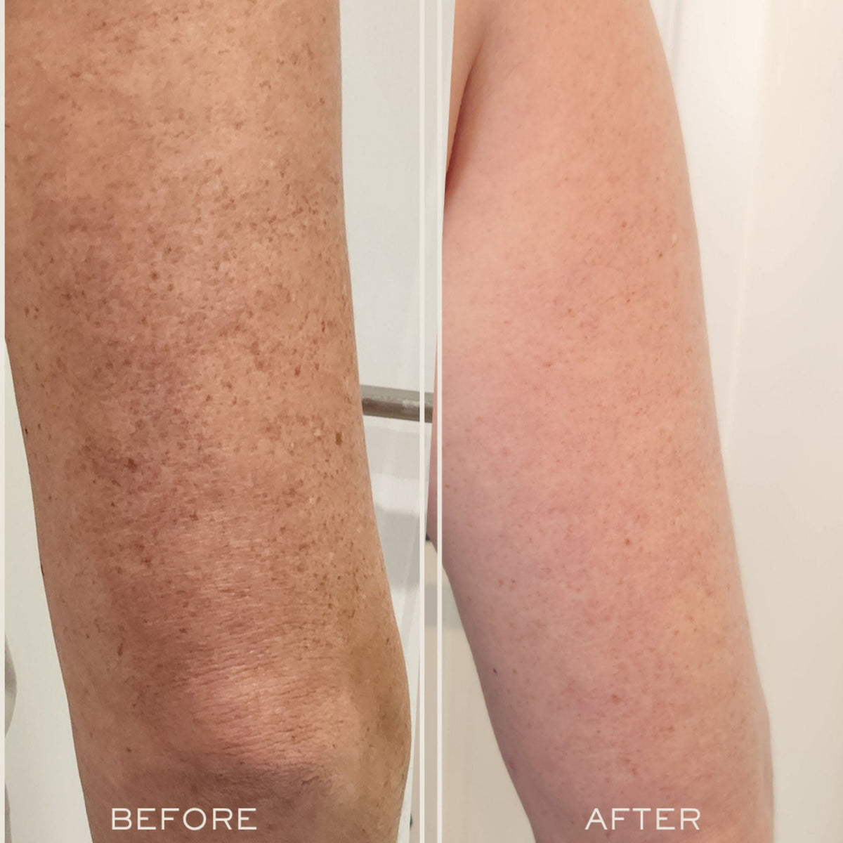 Exfoliating Body Serum