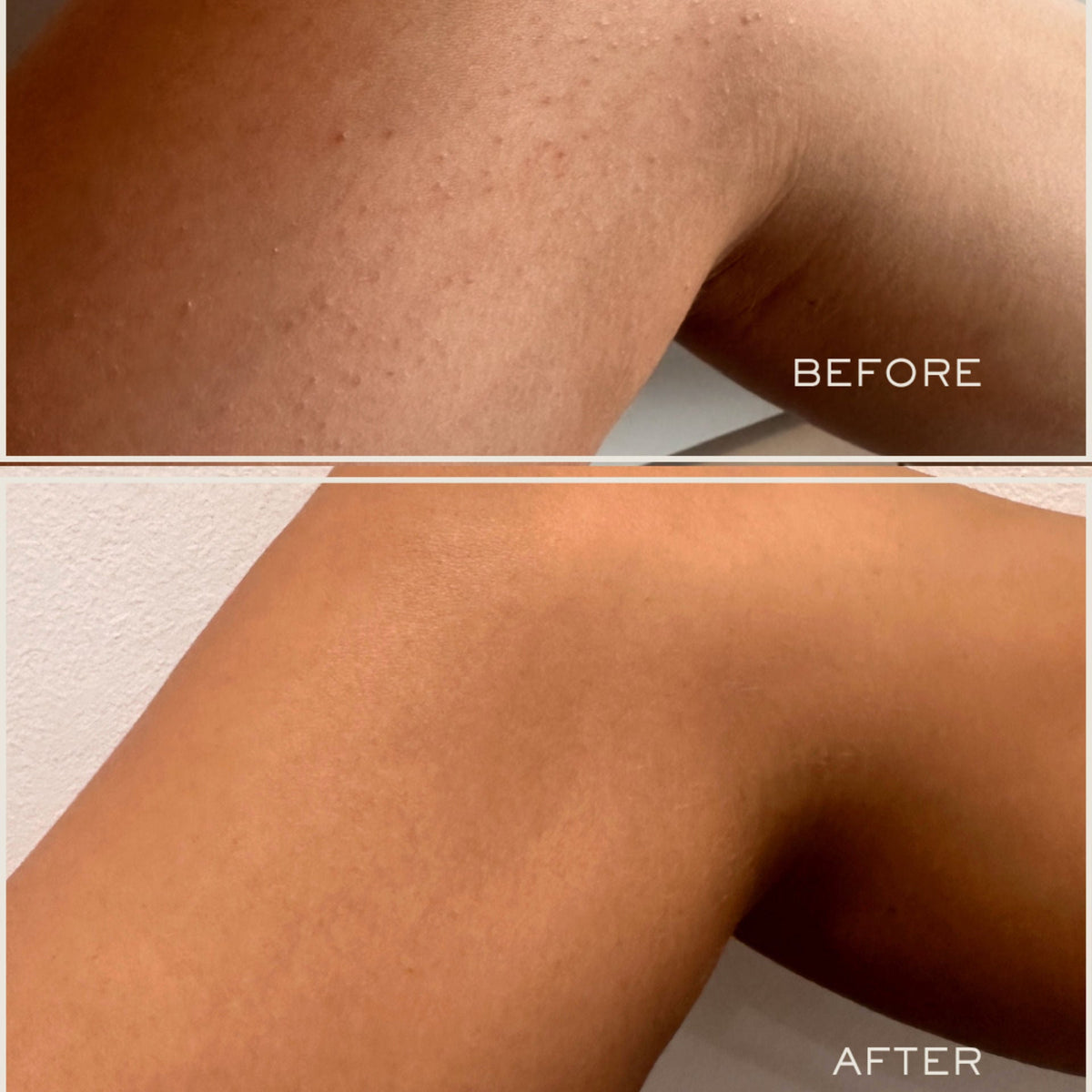Exfoliating Body Serum