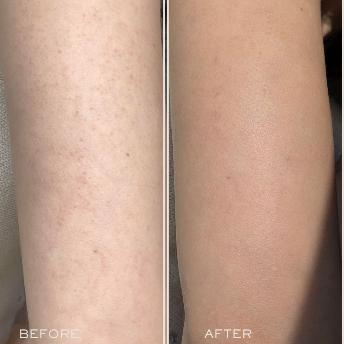 Exfoliating Body Serum