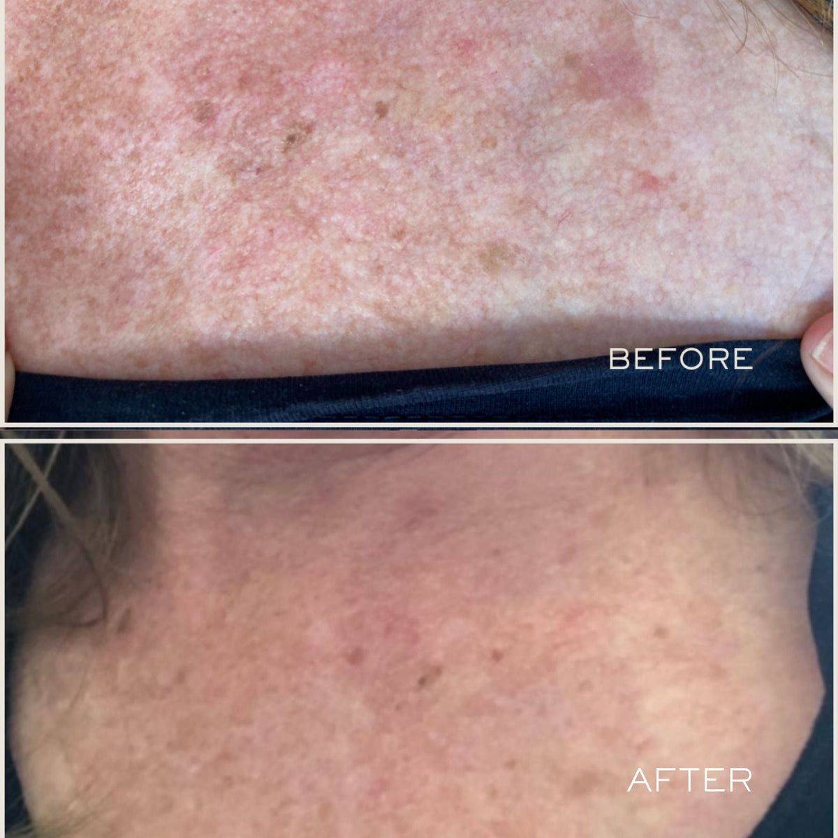 Exfoliating Body Serum