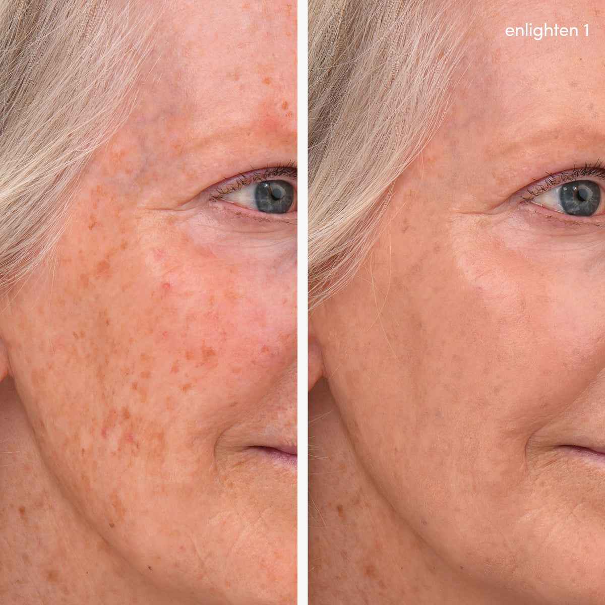 Enlighten Plus Under-Eye Concealer